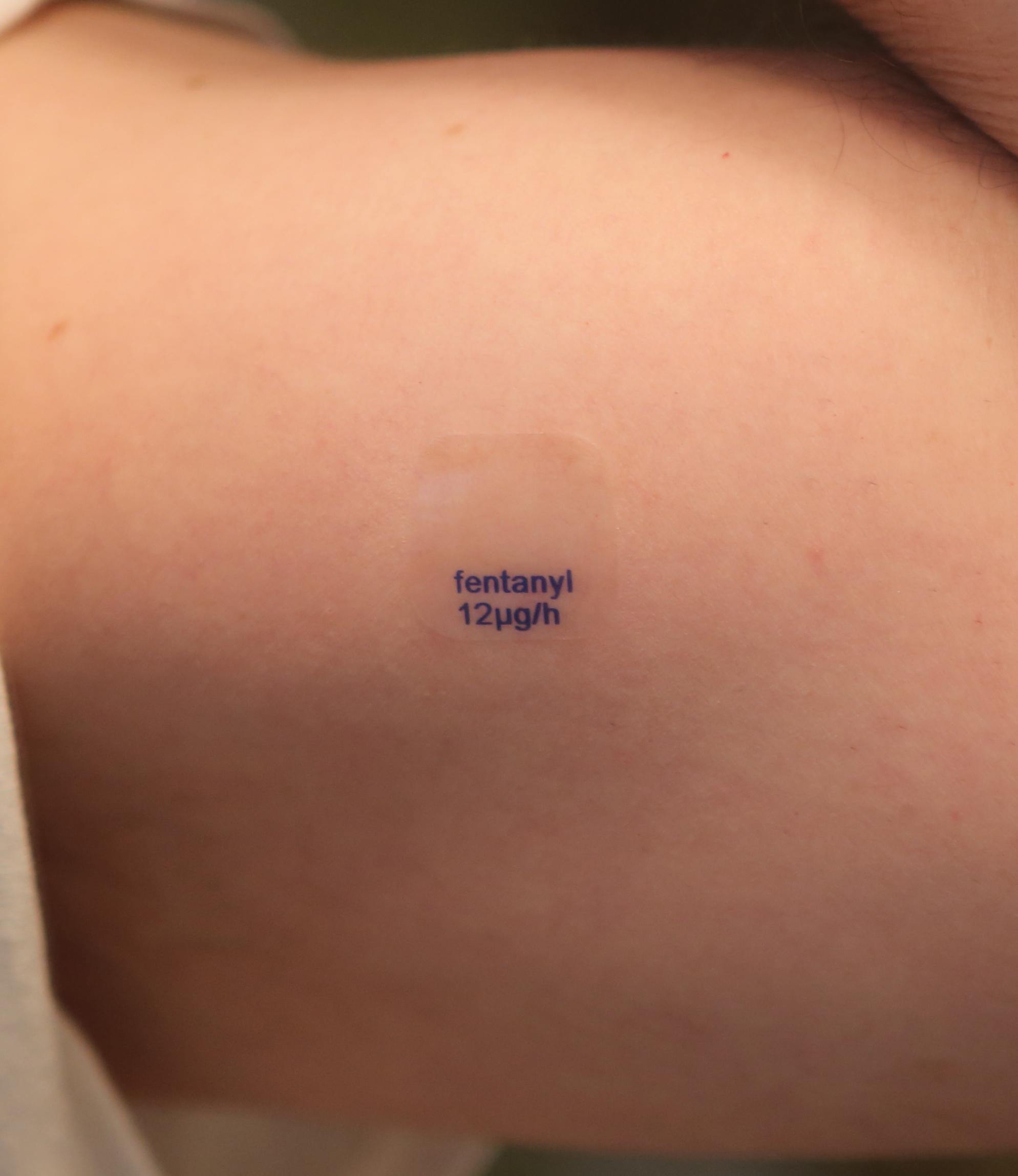 A fentanyl transdermal patch labeled 12 micrograms/hour.